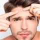 Illustration for article titled Acne Prevention – What Works